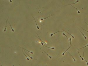 Spermatozoïdes